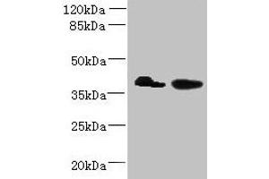 Western blot All lanes: L3HYPDH antibody at 8 μg/mL Lane 1: HepG2 whole cell lysate Lane 2: A549 whole cell lysate Secondary Goat polyclonal to rabbit IgG at 1/10000 dilution Predicted band size: 39 kDa Observed band size: 39 kDa (L3HYPDH 抗体  (AA 13-312))