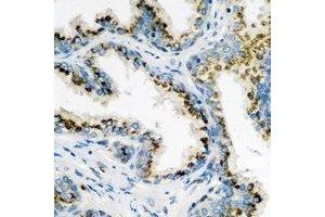 Immunohistochemical analysis of ARL6 staining in human prostate formalin fixed paraffin embedded tissue section. (ARL6 抗体)