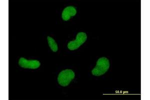 Immunofluorescence of purified MaxPab antibody to ZNF350 on HepG2 cell. (ZNF350 抗体  (AA 1-532))