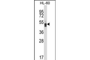HDAC7 Antibody (C-term) (ABIN657570 and ABIN2846576) western blot analysis in HL-60 cell line lysates (35 μg/lane). (HDAC7 抗体  (C-Term))