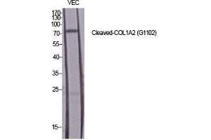 Western Blotting (WB) image for anti-Collagen, Type I, alpha 2 (COL1A2) (cleaved), (Gly1102) antibody (ABIN3181801)