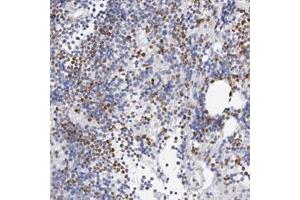 Immunohistochemical staining of human bone marrow with SLC10A5 polyclonal antibody  shows distinct nuclear and cytoplasmic positivity in subsets of bone marrow poietic cells. (SLC10A5 抗体)