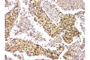 IHC analysis of EIF6 using anti-EIF6 antibody (ABIN6719594). (EIF6 抗体  (AA 66-210))