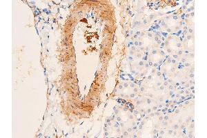 Immunohistochemistry (IHC) image for anti-Actin, alpha 2, Smooth Muscle, Aorta (ACTA2) (N-Term) antibody (ABIN6254917)