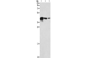 Western Blotting (WB) image for anti-Twinfilin, Actin-Binding Protein, Homolog 2 (Drosophila) (TWF2) antibody (ABIN2429403) (TWF2 抗体)