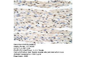 Rabbit Anti-HNRPDL Antibody  Paraffin Embedded Tissue: Human Muscle Cellular Data: Skeletal muscle cells Antibody Concentration: 4. (HNRPDL 抗体  (Middle Region))