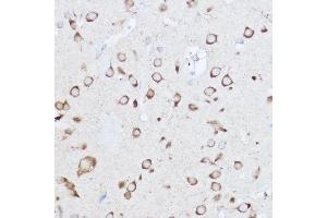 Immunohistochemistry (IHC) image for anti-YTH Domain Family, Member 3 (YTHDF3) (AA 1-275) antibody (ABIN6150345)