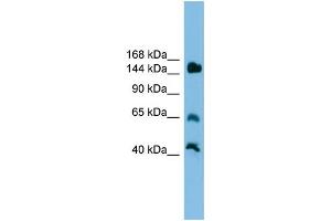 WB Suggested Anti-Jarid2 Antibody Titration: 0. (JARID2 抗体  (Middle Region))