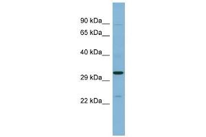 SET antibody used at 1 ug/ml to detect target protein. (SET/TAF-I 抗体  (N-Term))