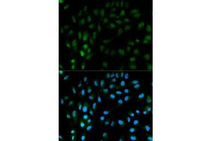anti-Tissue Factor Pathway Inhibitor (Lipoprotein-Associated Coagulation Inhibitor) (TFPI) (AA 29-224) antibody