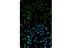 Immunofluorescence analysis of MCF7 cell using TFPI antibody. (TFPI 抗体  (AA 29-224))