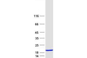 Western Blotting (WB) image for Eukaryotic Translation Initiation Factor 5A (EIF5A) (Transcript Variant B) protein (Myc-DYKDDDDK Tag) (ABIN2720107)