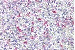 Immunohistochemistry with Spleen tissue at an antibody concentration of 5µg/ml using anti-EZH1 antibody (ARP38092_P050) (EZH1 抗体  (N-Term))