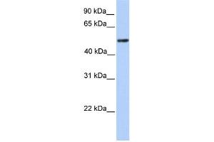 WB Suggested Anti-ZBTB9 Antibody Titration:  0. (ZBTB9 抗体  (C-Term))