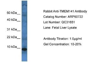 Western Blotting (WB) image for anti-Transmembrane Protein 141 (TMEM141) (C-Term) antibody (ABIN2774294) (TMEM141 抗体  (C-Term))