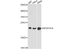 Western blot analysis of extracts of various cell lines, using NDUFAF4 antibody (ABIN6293778) at 1:3000 dilution. (NDUFAF4 抗体)