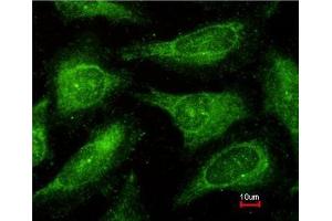 Immunofluorescence analysis of methanol-fixed HeLa, using c-Yes antibody at 1:200 dilution. (YES1 抗体)
