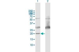 Western Blotting (WB) image for anti-ATP Synthase, H+ Transporting, Mitochondrial Fo Complex, Subunit D (ATP5H) (AA 1-161) antibody (ABIN523887)