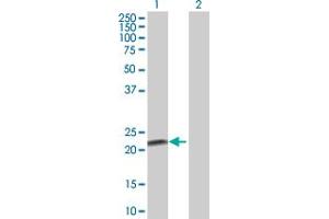Western Blot analysis of FKBP11 expression in transfected 293T cell line by FKBP11 MaxPab polyclonal antibody. (FKBP11 抗体  (AA 1-201))