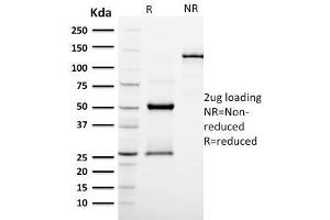 SDS-PAGE Analysis Purified EGFR Mouse Monoclonal Antibody (GFR/2596). (PODXL 抗体  (AA 310-447))