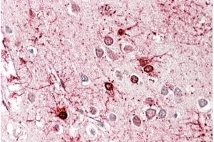 ABIN571123 (3. (GLUD1 / GLUD2 (Internal Region) 抗体)