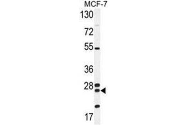 NUDT8 抗体  (N-Term)