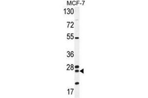 Western blot analysis of NUDT8 Antibody (N-term) in MCF-7 cell line lysates (35ug/lane). (NUDT8 抗体  (N-Term))