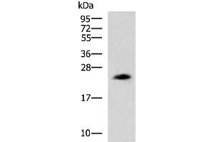 Western blot analysis of NIH/3T3 cell lysate using CLTB Polyclonal Antibody at dilution of 1:800 (CLTB 抗体)