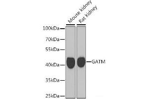 Western blot analysis of extracts of various cell lines using GATM Polyclonal Antibody at dilution of 1:1000. (GATM 抗体)