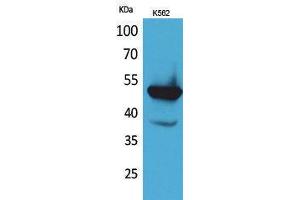 Western Blotting (WB) image for anti-Vitamin K-dependent protein C (PROC) (Internal Region) antibody (ABIN3178252) (PROC 抗体  (Internal Region))