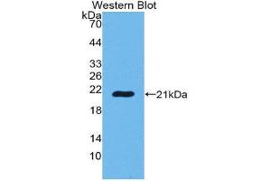 Western Blotting (WB) image for anti-POTE Ankyrin Domain Family, Member G (POTEG) (AA 177-330) antibody (ABIN1980492) (POTEG 抗体  (AA 177-330))