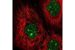 Immunofluorescent staining of A-431 cells with MAP3K9 polyclonal antibody  (Green) shows positivity in nucleus and nucleoli. (MAP3K9 抗体)