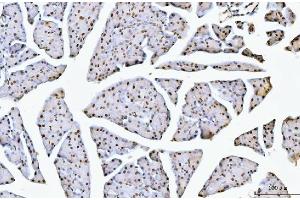 IHC analysis of NCL using anti-NCL antibody (ABIN7600662). (Nucleolin 抗体  (AA 219-629))
