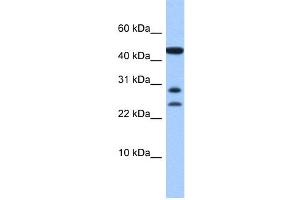 WB Suggested Anti-C20orf141 Antibody Titration: 0. (C20orf141 抗体  (Middle Region))