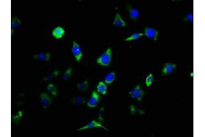 Immunofluorescence staining of SH-SY5Y cells with ABIN7147780 at 1:133, counter-stained with DAPI. (CNTF Receptor alpha 抗体  (AA 106-342))