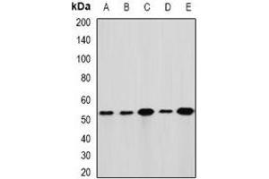 Western blot analysis of GLUD1 expression in Hela (A), HepG2 (B), mouse liver (C), mouse brain (D), rat kidney (E) whole cell lysates. (GLUD1 抗体)