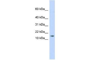 WB Suggested Anti-C11orf67 Antibody Titration: 0. (AAMDC 抗体  (Middle Region))