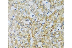 Immunohistochemistry of paraffin-embedded Human liver using C1QC Polyclonal Antibody at dilution of 1:100 (40x lens). (C1QC 抗体)