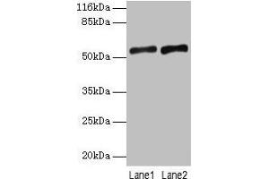 Western blot All lanes: SLC2A4 antibody at 2 μg/mL Lane 1: Mouse heart tissue Lane 2: Hela whole cell lysate Secondary Goat polyclonal to rabbit IgG at 1/10000 dilution Predicted band size: 55, 44 kDa Observed band size: 55 kDa (GLUT4 抗体  (AA 223-287))