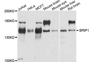 Western blot analysis of extracts of various cell lines, using BRIP1 antibody (ABIN5995423) at 1/1000 dilution. (BACH1 抗体)