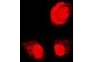 Immunofluorescent analysis of PSMB1 staining in U2OS cells. (PSMB1 抗体)