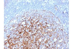 Formalin-fixed, paraffin-embedded human Tonsil stained with CD21-Monospecific Mouse Monoclonal Antibody (CR2/3247).