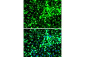 Immunofluorescence analysis of A549 cells using EIF2AK4 antibody. (GCN2 抗体)