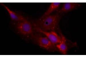 Image no. 1 for anti-Neurocan (NCAN) antibody (ABIN108596) (Neurocan 抗体)