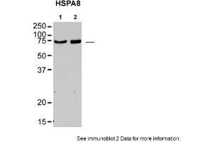 Sample type: rat brain lysatePrimary Dilution: 1:1000Image Submitted By: Jennifer Morgan, PhD &, David BuschUniversity of Texas in Austin (Hsc70 抗体  (N-Term))