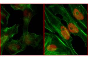 Immunofluorescence (IF) image for anti-Replication Protein A2, 32kDa (RPA2) (pSer4), (pSer8) antibody (ABIN7455212) (RPA2 抗体  (pSer4, pSer8))
