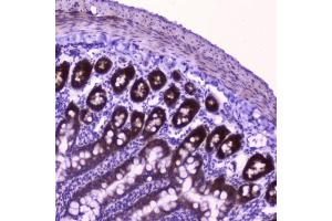 IHC testing of FFPE rat small intestine tissue with FLIP antibody at 2ug/ml.