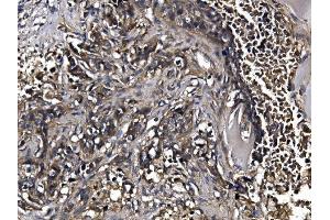 IHC analysis of KLHL12 using anti-KLHL12 antibody (ABIN7601009).