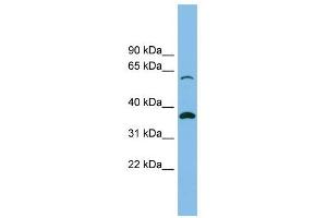 SLC25A4 antibody used at 1 ug/ml to detect target protein. (SLC25A4 抗体)