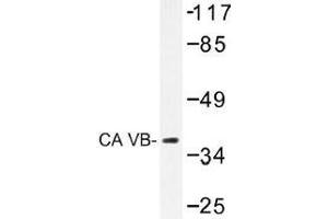 Image no. 1 for anti-Carbonic Anhydrase VB, Mitochondrial (CA5B) antibody (ABIN317824) (CA5B 抗体)